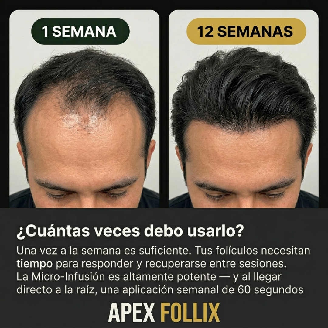 Apex Follix - Sistema de Crecimiento del Cabello