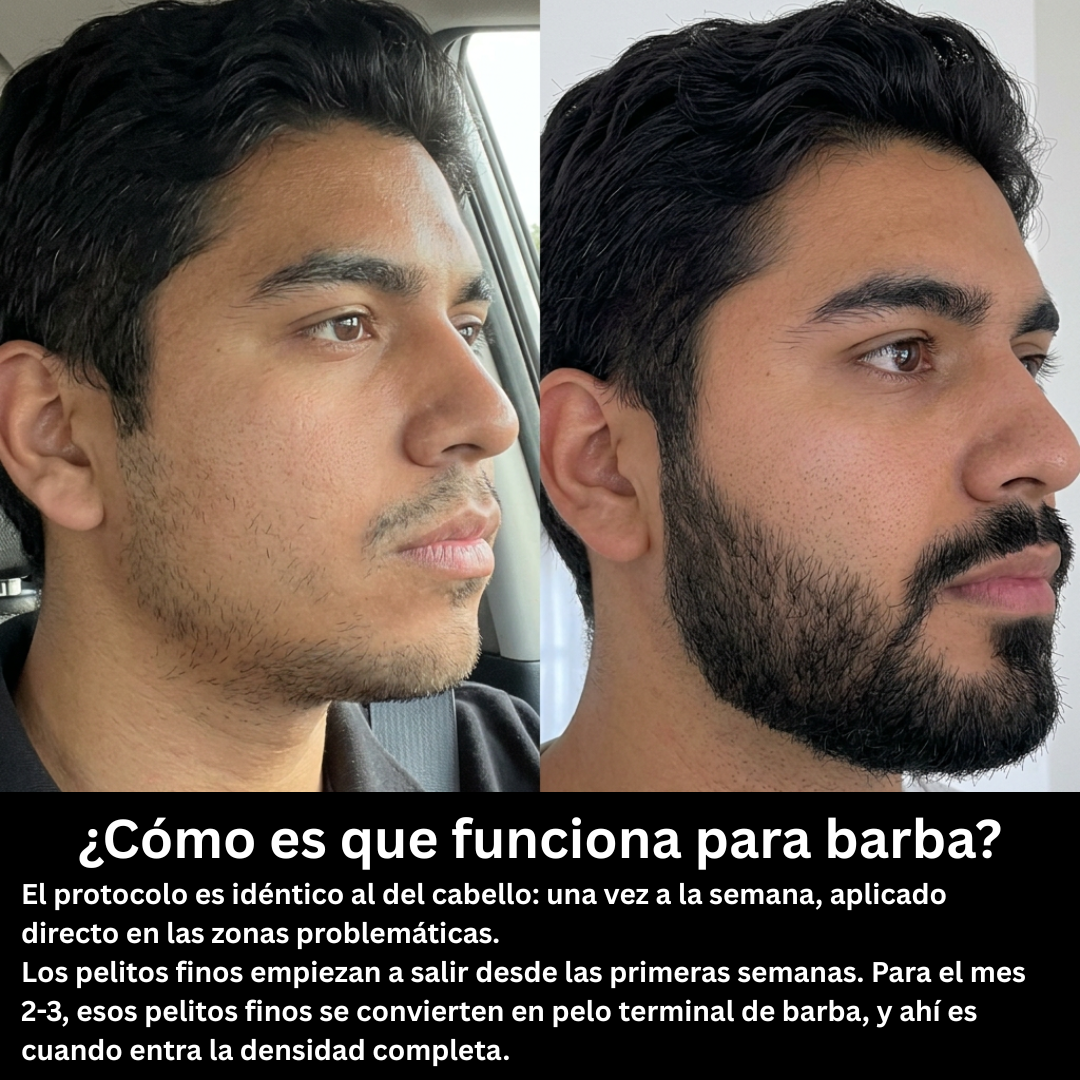 Apex Follix - Sistema de Crecimiento del Cabello y Barba