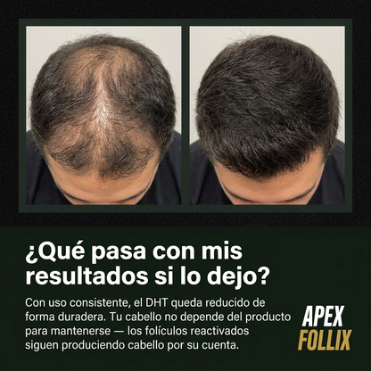 Apex Follix - Sistema de Crecimiento del Cabello